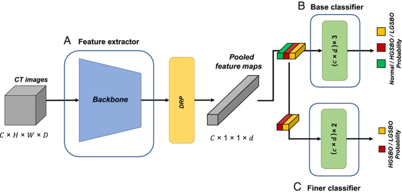 Figure 2 from the acute small bowel obstruction study showing the proposed CT diagnosis network workflow.