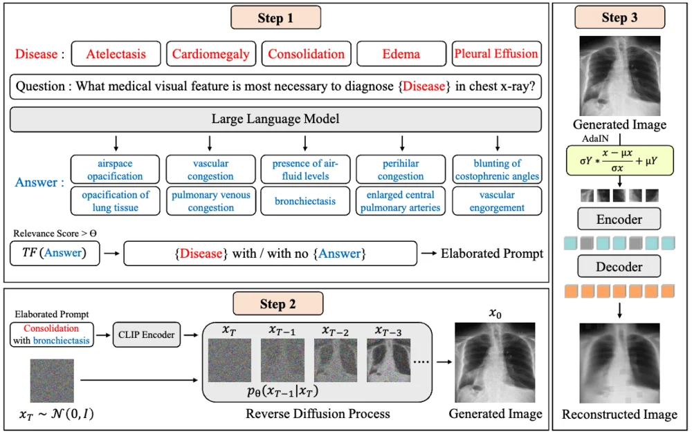 Medical Image Diagnosis figure