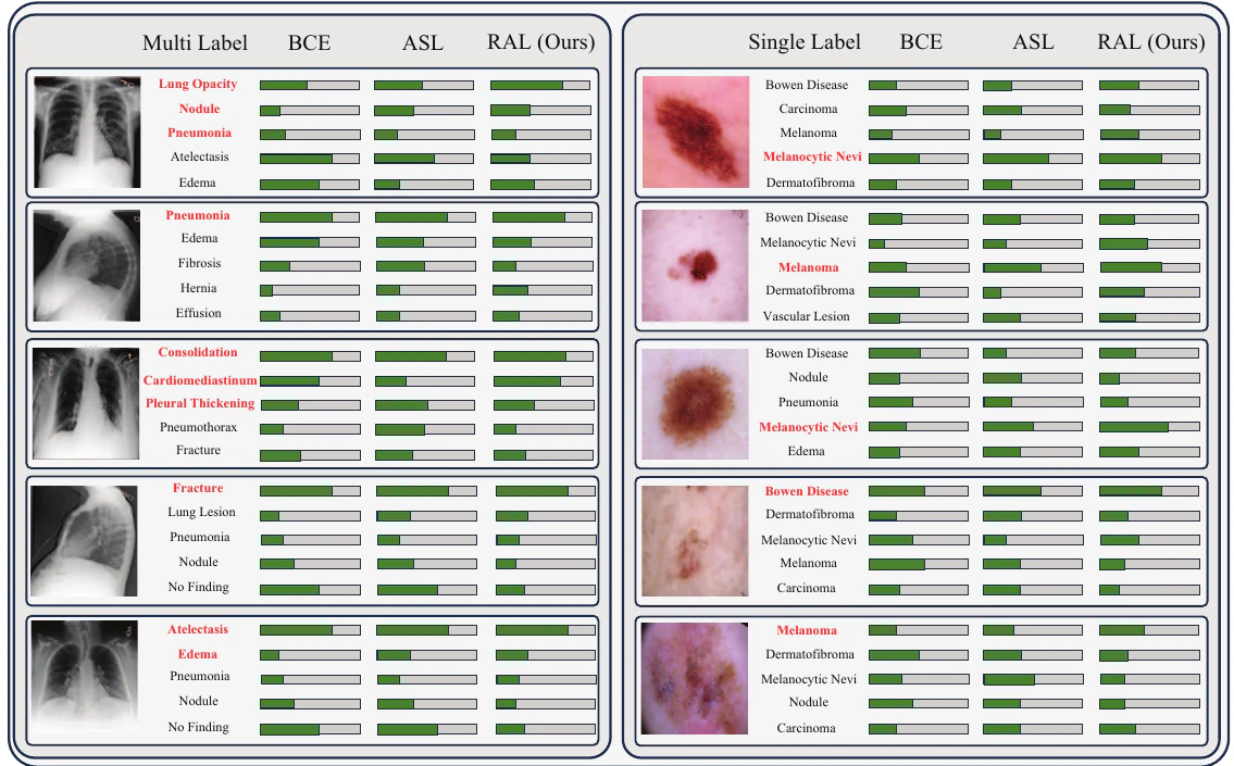 Figure 2 from the RAL paper comparing BCE, ASL, and robust asymmetric loss probabilities on multi-label and single-label medical images.